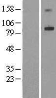 ADAM32 Protein - Western validation with an anti-DDK antibody * L: Control HEK293 lysate R: Over-expression lysate