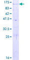 ADAM32 Protein - 12.5% SDS-PAGE of human ADAM32 stained with Coomassie Blue