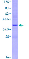 ADAM33 Protein - 12.5% SDS-PAGE of human ADAM33 stained with Coomassie Blue