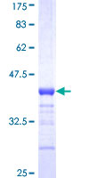 ADAM33 Protein - 12.5% SDS-PAGE Stained with Coomassie Blue.