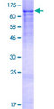 ADAM7 Protein - 12.5% SDS-PAGE of human ADAM7 stained with Coomassie Blue