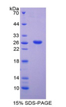 ADAM8 Protein - Recombinant A Disintegrin And Metalloprotease 8 By SDS-PAGE
