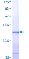 ADAM9 Protein - 12.5% SDS-PAGE Stained with Coomassie Blue.