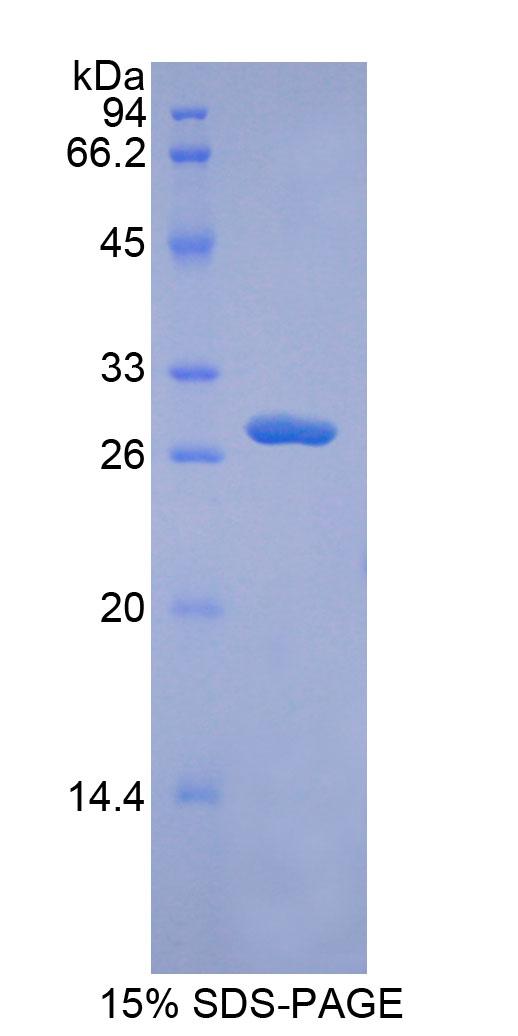 ADAM9 Protein - Recombinant A Disintegrin And Metalloprotease 9 By SDS-PAGE