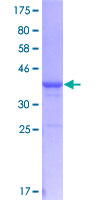ADAMDEC1 Protein - 12.5% SDS-PAGE Stained with Coomassie Blue.