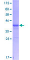 ADAMDEC1 Protein - 12.5% SDS-PAGE Stained with Coomassie Blue.