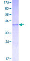 ADAMTS1 Protein - 12.5% SDS-PAGE Stained with Coomassie Blue.