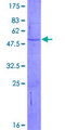 ADAMTS12 Protein - 12.5% SDS-PAGE of human ADAMTS12 stained with Coomassie Blue