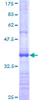 ADAMTS13 Protein - 12.5% SDS-PAGE Stained with Coomassie Blue.