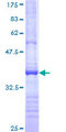 ADAMTS13 Protein - 12.5% SDS-PAGE Stained with Coomassie Blue.