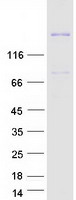 ADAMTS13 Protein - Purified recombinant protein ADAMTS13 was analyzed by SDS-PAGE gel and Coomassie Blue Staining