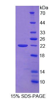 ADAMTS13 Protein - Recombinant Von Willebrand Factor Cleaving Protease (vWFCP) by SDS-PAGE