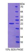 ADAMTS13 Protein - Recombinant Von Willebrand Factor Cleaving Protease (vWFCP) by SDS-PAGE