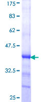 ADAMTS15 Protein - 12.5% SDS-PAGE Stained with Coomassie Blue.