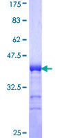ADAMTS17 Protein - 12.5% SDS-PAGE Stained with Coomassie Blue.