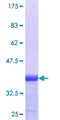 ADAMTS18 Protein - 12.5% SDS-PAGE Stained with Coomassie Blue.