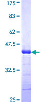ADAMTS2 Protein - 12.5% SDS-PAGE Stained with Coomassie Blue.