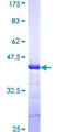 ADAMTS2 Protein - 12.5% SDS-PAGE Stained with Coomassie Blue.