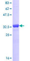 ADAMTS3 Protein - 12.5% SDS-PAGE Stained with Coomassie Blue.