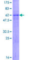 ADAMTS4 Protein - 12.5% SDS-PAGE of human ADAMTS4 stained with Coomassie Blue