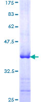 ADAMTS4 Protein - 12.5% SDS-PAGE Stained with Coomassie Blue.