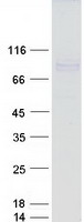 ADAMTS4 Protein - Purified recombinant protein ADAMTS4 was analyzed by SDS-PAGE gel and Coomassie Blue Staining