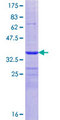 ADAMTS5 Protein - 12.5% SDS-PAGE Stained with Coomassie Blue.