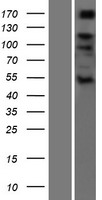 ADAMTS6 Protein - Western validation with an anti-DDK antibody * L: Control HEK293 lysate R: Over-expression lysate
