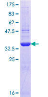 ADAMTS6 Protein - 12.5% SDS-PAGE Stained with Coomassie Blue.