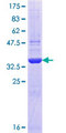 ADAMTS6 Protein - 12.5% SDS-PAGE Stained with Coomassie Blue.