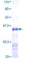 ADAMTS7 Protein - 12.5% SDS-PAGE Stained with Coomassie Blue.