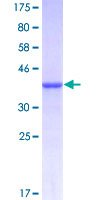 ADAMTS8 Protein - 12.5% SDS-PAGE Stained with Coomassie Blue.