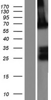 ADAMTSL1 Protein - Western validation with an anti-DDK antibody * L: Control HEK293 lysate R: Over-expression lysate