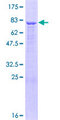 ADAMTSL1 Protein - 12.5% SDS-PAGE of human ADAMTSL1 stained with Coomassie Blue