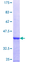 ADAMTSL1 Protein - 12.5% SDS-PAGE Stained with Coomassie Blue.