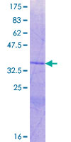 ADAMTSL3 Protein - 12.5% SDS-PAGE Stained with Coomassie Blue.