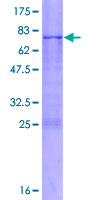 ADAMTSL4 Protein - 12.5% SDS-PAGE of human ADAMTSL4 stained with Coomassie Blue
