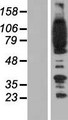 ADAP / FYB Protein - Western validation with an anti-DDK antibody * L: Control HEK293 lysate R: Over-expression lysate