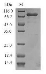 ADAP1 / CENTA1 Protein - (Tris-Glycine gel) Discontinuous SDS-PAGE (reduced) with 5% enrichment gel and 15% separation gel.