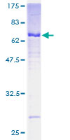 ADAP2 / CENTA2 Protein - 12.5% SDS-PAGE of human CENTA2 stained with Coomassie Blue