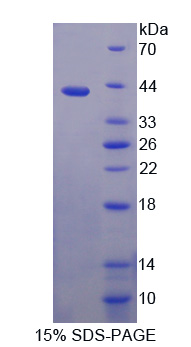 ADAP2 / CENTA2 Protein - Recombinant  Centaurin Alpha 2 By SDS-PAGE