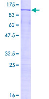 ADAR2 / ADARB1 Protein - 12.5% SDS-PAGE of human ADARB1 stained with Coomassie Blue