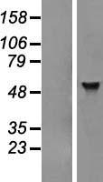 ADAT1 Protein - Western validation with an anti-DDK antibody * L: Control HEK293 lysate R: Over-expression lysate
