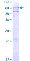 ADAT1 Protein - 12.5% SDS-PAGE of human ADAT1 stained with Coomassie Blue