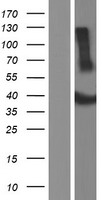 ADAT3 Protein - Western validation with an anti-DDK antibody * L: Control HEK293 lysate R: Over-expression lysate