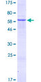 ADAT3 Protein - 12.5% SDS-PAGE of human ADAT3 stained with Coomassie Blue