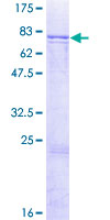 ADCK1 Protein - 12.5% SDS-PAGE of human ADCK1 stained with Coomassie Blue