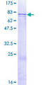 ADCK1 Protein - 12.5% SDS-PAGE of human ADCK1 stained with Coomassie Blue