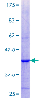 ADCK1 Protein - 12.5% SDS-PAGE Stained with Coomassie Blue.