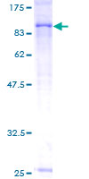 ADCK3 / CABC1 Protein - 12.5% SDS-PAGE of human CABC1 stained with Coomassie Blue